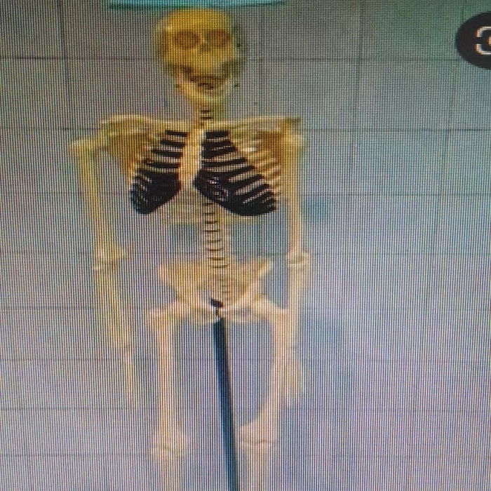 KERANGKA MANUSIA DEWASA